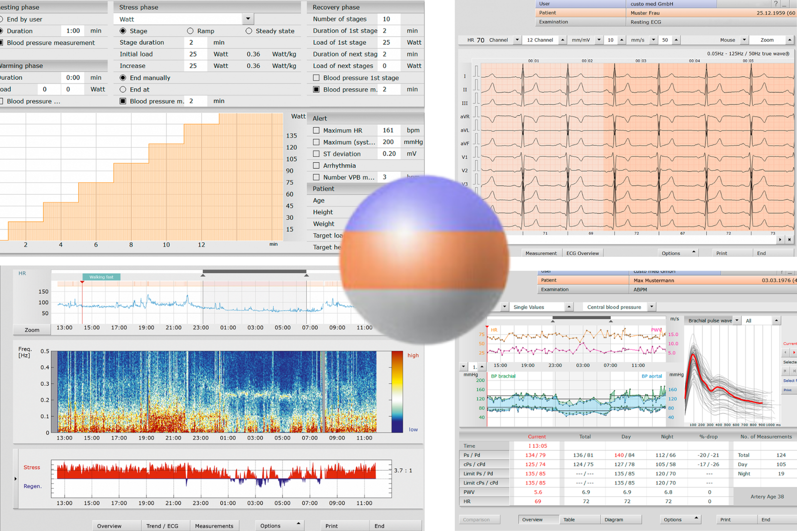 Cardiology equipment and softwares | Explore cardiac Software | cardiopulmonary custo-med software - Optimize patient care with custo diagnostic's integrated cardiopulmonary solutions. Streamline workflow, enhance reporting, and improve outcomes by Bettermeditech Trading - Medical Equipments Supplier in Qatar