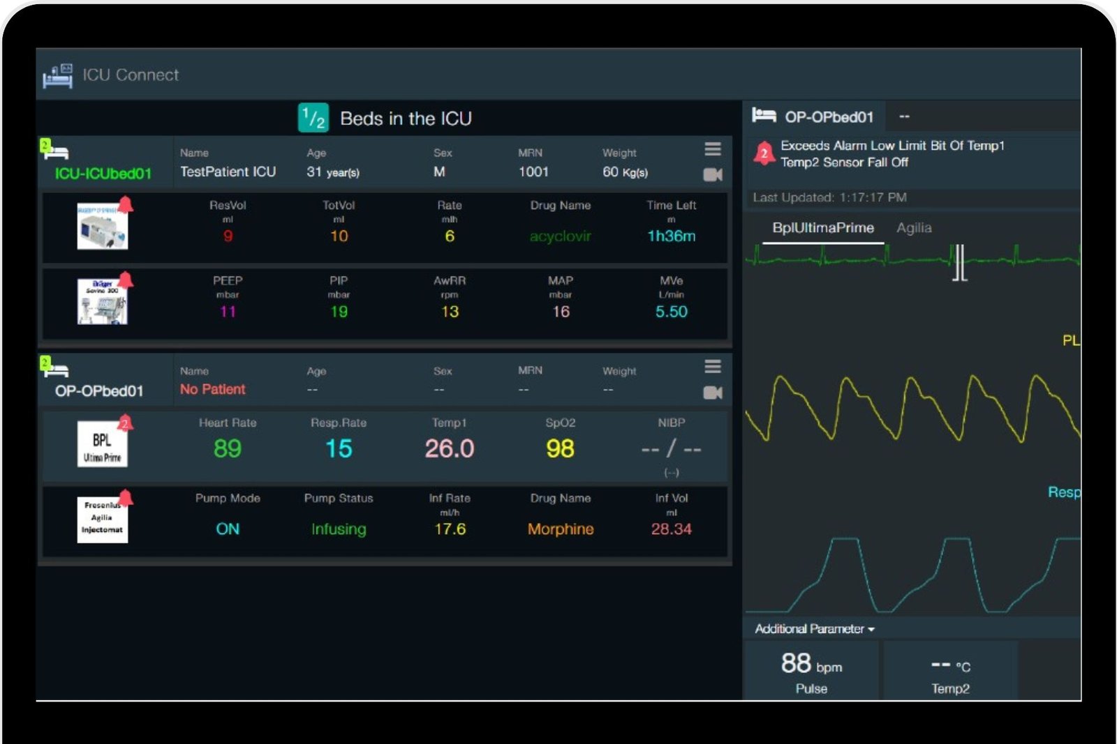 Medical Device Integration now in Qatar: Experience seamless healthcare with D-Assist: Your all-in-one solution for real-time event monitoring and efficient patient management. Our robust charting tool simplifies patient intake, medication, output tracking, and staff scheduling. Enjoy live event monitoring, effortless patient management, comprehensive output tracking, and efficient staff scheduling. Ensure accurate and up-to-date patient records with real-time event recording and editing. Effortlessly configure, add, and delete patient medication and intake information. Thoroughly assess and analyze patient output data with our advanced monitoring capabilities. Streamline staff management, especially in critical areas like OT or ICU rooms. Elevate your healthcare workflow with D-Assist's comprehensive charting and management features. Your path to efficient, accurate, and simplified healthcare starts here! Now available from trading, leading medical equipment suppliers, and Medical Device Integration in Qatar and Middle East.